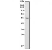 Western blot testing of human HepG2 cell lysate with FGB antibody. Predicted molecular weight ~56 kDa.