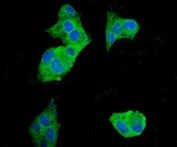 Immunofluorescent staining of FFPE human HepG2 cells with EEF2 antibody (green) and DAPI nuclear stain (blue). HIER: steam section in pH6 citrate buffer for 20 min.