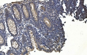 IHC staining of FFPE human appendicitis tissue with APPL1 antibody. HIER: boil tissue sections in pH8 EDTA for 20 min and allow to cool before testing.