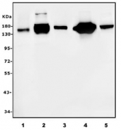 Western blot testing of 1) human ThP-1, 2) PC-3, 3) monkey kidney, 4) rat kidney and 5) rat liver lysate with ANPEP antibody. Expected molecular weight: 110-150 kDa depending on glycosylation level.