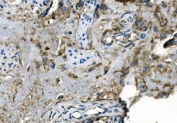 IHC staining of FFPE human placenta with Carbonic Anhydrase I antibody. HIER: boil tissue sections in pH8 EDTA for 20 min and allow to cool before testing.