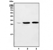 Western blot testing of 1) human K562, 2) rat spleen and 3) mouse spleen lysate with CA1 antibody. Predicted molecular weight: ~29 kDa.