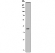 Western blot testing of human HEK293 cell lysate with CA10 antibody. Predicted molecular weight ~38 kDa.