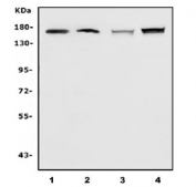 Western blot testing of 1) human A549, 2) human HEK293, 3) rat liver and 4) mouse liver lysate with Cadherin 2 antibody. Predicted molecular weight ~100 kDa (unmodified), 125-140 kDa (modified).