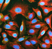 Immunofluorescent staining of FFPE human HeLa cells with Cadherin 2 antibody (green), Alpha Tubulin mAb (red) and DAPI nuclear stain (blue). HIER: steam section in pH6 citrate buffer for 20 min.