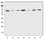 Western blot testing of human 1) HeLa, 2) A549, 3) U-2 OS, 4) U-87 MG, 5) A431, 6) rat lung and 7) mouse lung lysate with K-Cadherin antibody. Predicted molecular weight ~88 kDa.