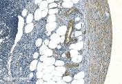 IHC staining of FFPE human appendicitis tissue with Cadherin 13 antibody. HIER: boil tissue sections in pH8 EDTA for 20 min and allow to cool before testing.