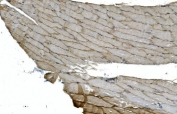 IHC staining of FFPE human skeletal muscle with Cadherin 13 antibody. HIER: boil tissue sections in pH8 EDTA for 20 min and allow to cool before testing.