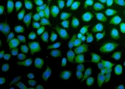Immunofluorescent staining of FFPE human SiHa cells with Cadherin 13 antibody (green) and DAPI nuclear stain (blue). HIER: steam section in pH6 citrate buffer for 20 min.