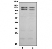Western blot testing of human 1) U-87 MG and 2) HeLa lysate with Cadherin 13 antibody. Predicted molecular weight ~130 kDa (pro form) and ~105 kDa (cleaved form).