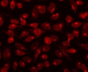 Immunofluorescent staining of FFPE human HeLa cells with CDK13 antibody. HIER: steam section in pH6 citrate buffer for 20 min.