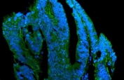 Immunofluorescent staining of FFPE human rectal cancer with Claudin 7 antibody (green) and DAPI nuclear stain (blue). HIER: steam section in pH8 EDTA for 20 min.