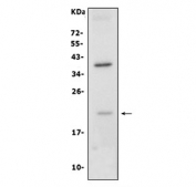 Western blot testing of human Caco-2 cell lysate with Claudin 7 antibody. Predicted molecular weight ~22 kDa.