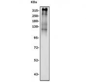 Western blot testing of human HeLa cell lysate with COL7A1 antibody. Expected molecular weight: 259-300 kDa.