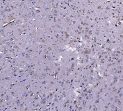 IHC staining of FFPE rat brain tissue with Elongation factor 2 antibody. HIER: boil tissue sections in pH8 EDTA for 20 min and allow to cool before testing.