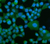 Immunofluorescent staining of FFPE human A431 cells with Elongation factor 2 antibody (green) and DAPI nuclear stain (blue). HIER: steam section in pH6 citrate buffer for 20 min.