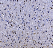 IHC staining of FFPE mouse brain tissue with Elongation factor 2 antibody. HIER: boil tissue sections in pH8 EDTA for 20 min and allow to cool before testing.