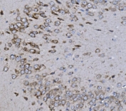 IHC staining of FFPE rat brain with KCNQ5 antibody. HIER: boil tissue sections in pH8 EDTA for 20 min and allow to cool before testing.
