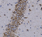 IHC staining of FFPE mouse brain with KCNQ5 antibody. HIER: boil tissue sections in pH8 EDTA for 20 min and allow to cool before testing.