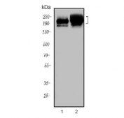 Western blot testing of 1) rat brain and 2) mouse brain lysate with Neurofilament heavy antibody. Predicted molecular weight ~112 kDa, often visualized at ~200 kDa.