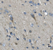 IHC staining of FFPE rat brain with Neurofilament heavy antibody. HIER: boil tissue sections in pH8 EDTA for 20 min and allow to cool before testing.