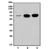 Western blot testing of 1) human SH-SY5Y, 2) rat brain and 3) mouse brain lysate with Neurofilament Light antibody. Predicted molecular weight: 62-68 kDa.