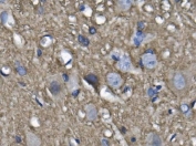 IHC staining of FFPE rat spinal cord with Neurofilament Light antibody. HIER: boil tissue sections in pH8 EDTA for 20 min and allow to cool before testing.