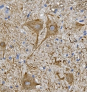 IHC staining of FFPE mouse spinal cord with Neurofilament Light antibody. HIER: boil tissue sections in pH8 EDTA for 20 min and allow to cool before testing.