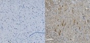 IHC staining of FFPE mouse spinal cord (right) and negative control (left) with Neurofilament Light antibody. HIER: boil tissue sections in pH8 EDTA for 20 min and allow to cool before testing.