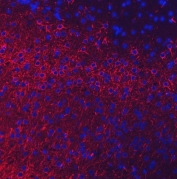 Immunofluorescent staining of FFPE mouse brain tissue with Neurofilament Light antibody (red) and DAPI nuclear stain (blue). HIER: boil tissue sections in pH8 EDTA for 20 min and allow to cool before testing.