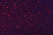 Immunofluorescent staining of FFPE rat brain tissue with Neurofilament Light antibody (red) and DAPI nuclear stain (blue). HIER: boil tissue sections in pH8 EDTA for 20 min and allow to cool before testing.