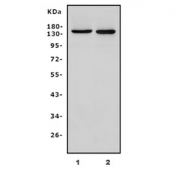 Western blot testing of 1) rat skeletal muscle and 2) mouse skeletal muscle lysate with PARP9 antibody. Predicted molecular weight ~96 kDa.