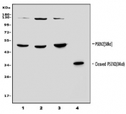 Western blot testing of human 1) placenta, 2) HEK293, 3) Caco-2 and 4) mouse kidney lysate with PSEN2 antibody. Predicted molecular weight: ~50 kDa.