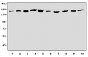 Western blot testing of human 1) HeLa, 2) K562, 3) HT1080, 4) U-87 MG, 5) Caco-2, 6) rat brain, 7) rat PC-12, 8) mouse brain, 9) mouse lung and 10) mouse NIH 3T3 cell lysate with ROCK2 antibody. Predicted molecular weight ~161 kDa.