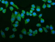 Immunofluorescent staining of FFPE human HepG2 cells with ROCK2 antibody (green) and DAPI nuclear stain (blue). HIER: steam section in pH6 citrate buffer for 20 min.