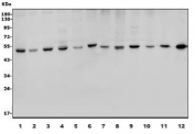 Western blot testing of human 1) HeLa, 2) U-87 MG, 3) MDA-MB-453, 4) MCF7, 5) Jurkat, 6) ThP-1 and rat 7) lung, 8) thymus, 9) skeletal muscle, 10) testis and mouse 11) lung and 12) thymus lysate with SP7 antibody. Predicted molecular weight ~45 kDa.