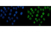 Immunofluorescent staining of FFPE human A431 cells with PARP antibody (green) and DAPI nuclear stain (blue). HIER: steam section in pH6 citrate buffer for 20 min.