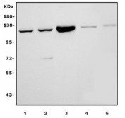 Western blot testing of human 1) MCF7, 2) HeLa, 3) HEK293, 4) rat testis and 5) mouse testis lysate with PARP1 antibody. Predicted molecular weight ~116 kDa.