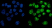 Immunofluorescent staining of FFPE human A431 cells with PARP1 antibody (green) and DAPI nuclear stain (blue). HIER: steam section in pH6 citrate buffer for 20 min.