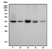 Western blot testing of human 1) HeLa, 2) Caco-2, 3) HEK293, 4) U-87 MG and 5) rat brain lysate with Mannose Phosphate Isomerase antibody. Predicted molecular weight ~47 kDa.