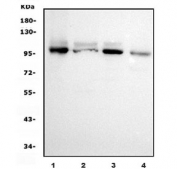 Western blot testing of human 1) Jurkat, 2) HEK293, 3) Raji and 4) monkey COS-7 cell lysate with Ubiquitin-protein ligase E3A antibody. Predicted molecular weight ~100 kDa.