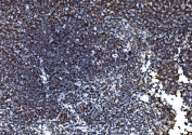 IHC staining of FFPE mouse thymus with PORC-PI-1 antibody. HIER: boil tissue sections in pH8 EDTA for 20 min and allow to cool before testing.