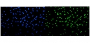 Immunofluorescent staining of FFPE human A549 cells with TKT antibody (green) and DAPI nuclear stain (blue). HIER: steam section in pH6 citrate buffer for 20 min.