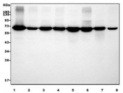 Western blot testing of human 1) A549, 2) HepG2, 3) SW620, 4) Raji, 5) rat liver, 6) rat RH35, 7) mouse liver and 8) mouse HEPA1-6 cell lysate with TKT antibody. Predicted molecular weight ~68 kDa.