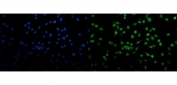 Immunofluorescent staining of FFPE human A549 cells with Transketolase antibody (green) and DAPI nuclear stain (blue). HIER: steam section in pH6 citrate buffer for 20 min.
