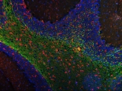 Immunofluorescent staining of FFPE rat cerebellum tissue with Siglec-4a antibody (green), GFAP antibody (red) and DAPI nuclear stain (blue). HIER: steam section in pH6 citrate buffer for 20 min.