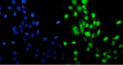 Immunofluorescent staining of FFPE human A431 cells with MCM5 antibody (green) and DAPI nuclear stain (blue). HIER: steam section in pH6 citrate buffer for 20 min.