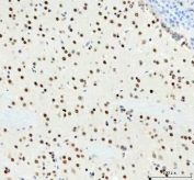 IHC staining of FFPE rat brain tissue with DDX1 antibody. HIER: boil tissue sections in pH8 EDTA for 20 min and allow to cool before testing.