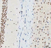 IHC staining of FFPE mouse brain tissue with DDX1 antibody. HIER: boil tissue sections in pH8 EDTA for 20 min and allow to cool before testing.