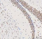 IHC staining of FFPE mouse brain tissue with DDX1 antibody. HIER: boil tissue sections in pH8 EDTA for 20 min and allow to cool before testing.